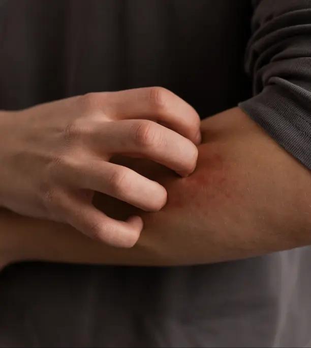 Disease spreads more easily within households and communities